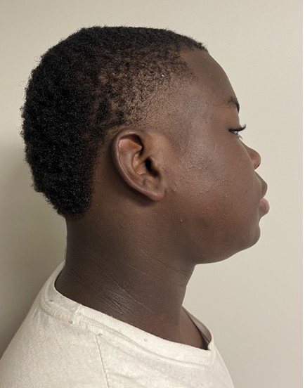 Jamarion Laron Fields